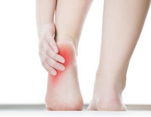 Plantar Fasciitis