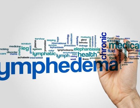 Lymphoedema & Physiotherapy