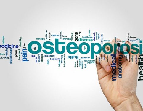 High Impact Exercise and Osteoporosis