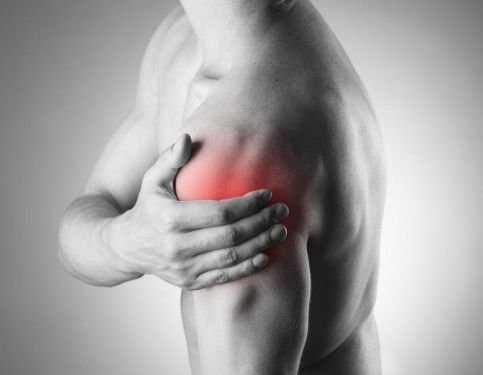 Shoulder Impingement & Exercise