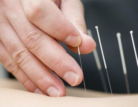 Acupuncture in Lichfield