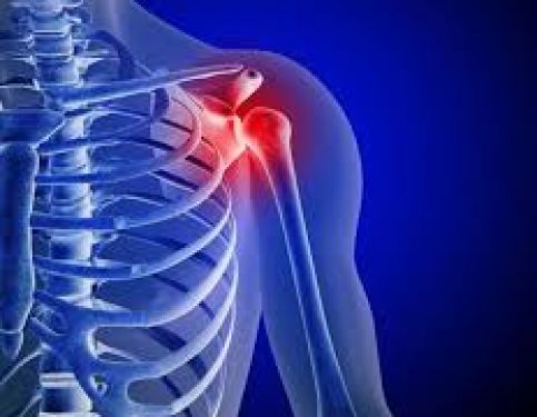 Shoulder Pain and Physiotherapy