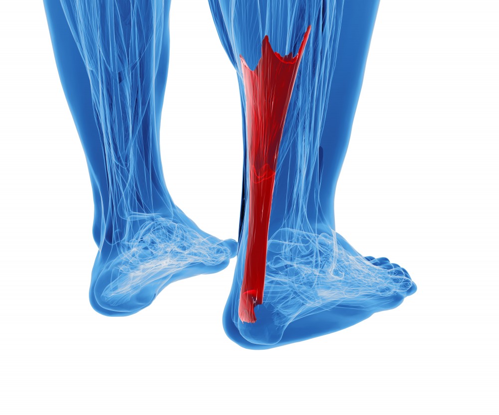 Achilles Tendinopathy